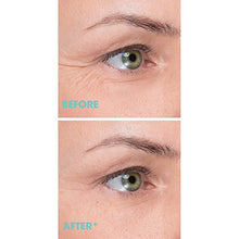 Carica l'immagine nel visualizzatore di Gallery, Remescar - Crema Zampe di gallina - contorno occhi clinicamente...