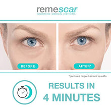 Carica l'immagine nel visualizzatore di Gallery, Remescar - Borse Occhi e Occhiaie Scure - Crema per le borse sotto gli occhi...