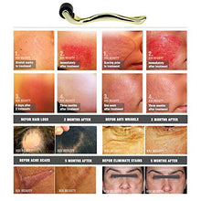 Carica l'immagine nel visualizzatore di Gallery, TBPHP Micro Needle Roller 0.5mm 540-aghi Derma rullo di alta qualità,il... - Ilgrandebazar