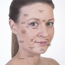 Carica l'immagine nel visualizzatore di Gallery, Set per Coppettazione - Coppetta Massaggio Anticellulite - Blu 4 pezzi - Ilgrandebazar