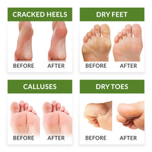 Carica l'immagine nel visualizzatore di Gallery, FitFoot maschera piedi esfoliante baby foot peeling calzini Verde - Ilgrandebazar