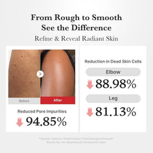 Carica l'immagine nel visualizzatore di Gallery, medicube Body Peel Shot with Hypochlorous Acid