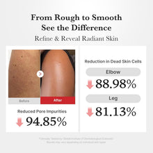 Carica l'immagine nel visualizzatore di Gallery, medicube Body Peel Shot with Hypochlorous Acid