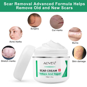 Cicatrici Crema, Scar cream Rimuovere Cicatrici Chirurgiche, Cicatrici Acne i Smagliature Veloce Efficace Su Cheloide, Ustione, Bruciatura