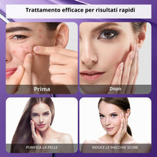 Carica l'immagine nel visualizzatore di Gallery, Acido Azelaico, 12% Azelaic Acid Serum, Acido Salicilico Viso, 1pz