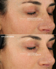 Carica l'immagine nel visualizzatore di Gallery, Crema Viso Antirughe Acido ialuronico con Retinolo e Collagene - Eletta Miglior Crema Antirughe Donna e Uomo per Rughe, Macchie Scure e Linee Sottili - 50ml