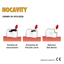 Carica l'immagine nel visualizzatore di Gallery, Nocavity - Kit per Otturazioni Dentali Provvisorie - Cemento che Isola la Cavità Dentale e Riduce il Dolore in Caso di P