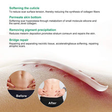 Carica l&#39;immagine nel visualizzatore di Gallery, Cicatrici Crema, Scar cream Rimuovere Cicatrici Chirurgiche, Cicatrici Acne i Smagliature Veloce Efficace Su Cheloide, Ustione, Bruciatura