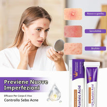 Carica l'immagine nel visualizzatore di Gallery, Acido Azelaico, 12% Azelaic Acid Serum, Acido Salicilico Viso, 1pz
