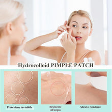 Carica l'immagine nel visualizzatore di Gallery, 300 Pezzi Pimple Patch Brufoli Cerotti Invisibili Viso Acne Patch
