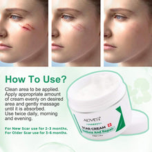 Carica l&#39;immagine nel visualizzatore di Gallery, Cicatrici Crema, Scar cream Rimuovere Cicatrici Chirurgiche, Cicatrici Acne i Smagliature Veloce Efficace Su Cheloide, Ustione, Bruciatura