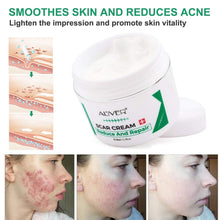 Carica l&#39;immagine nel visualizzatore di Gallery, Cicatrici Crema, Scar cream Rimuovere Cicatrici Chirurgiche, Cicatrici Acne i Smagliature Veloce Efficace Su Cheloide, Ustione, Bruciatura