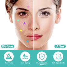 Carica l'immagine nel visualizzatore di Gallery, Cerotti Brufoli Pimple, Patch Brufoli Invisibili 2-In-1, 400pz