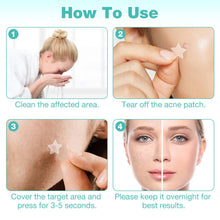 Carica l'immagine nel visualizzatore di Gallery, Cerotti Brufoli Pimple, Patch Brufoli Invisibili 2-In-1, 400pz