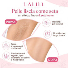 Carica l'immagine nel visualizzatore di Gallery, LALILL Strisce in Pile 100 Pezzi - per la Depilazione con Cera Calda e Pasta di Zucchero Epilatoria Viso - per Corpo