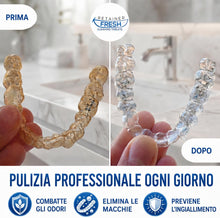 Carica l'immagine nel visualizzatore di Gallery, Retainer Fresh Compresse detergenti per apparecchio ortodontico 120 Unità