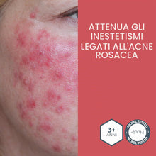 Carica l'immagine nel visualizzatore di Gallery, MOST - Crema 2s con Acido Salicilico e Zolfo, Crema Viso e Corpo Controlla Rossori e Prurito, Attenua Sfoghi da Stress, 