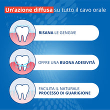 Carica l'immagine nel visualizzatore di Gallery, Gengigel Gel Acido Ialuronico, Trattamento Gengive Infiammate, 20 ml