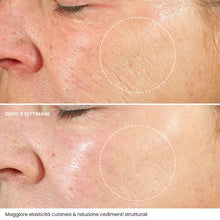 Carica l'immagine nel visualizzatore di Gallery, Crema Viso Antirughe Acido ialuronico con Retinolo e Collagene - Eletta Miglior Crema Antirughe Donna e Uomo per Rughe, Macchie Scure e Linee Sottili - 50ml