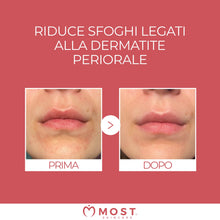 Carica l'immagine nel visualizzatore di Gallery, MOST - Crema 2s con Acido Salicilico e Zolfo, Crema Viso e Corpo Controlla Rossori e Prurito, Attenua Sfoghi da Stress, 
