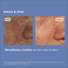 Carica l'immagine nel visualizzatore di Gallery, ISDIN Nutradeica Seborrheic Skin Gel Crema Viso (50 ml) | Idrata, Lenisce e Opacizza | Per Pelli a Tendenza Seborroica |