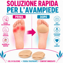 Carica l'immagine nel visualizzatore di Gallery, ROOTZ | Cuscinetti Metatarsali Donna e Uomo (1 Paio) | Solette Metatarso in Gel e Tessuto per Dolore da Metatarsalgia e 