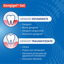 Carica l'immagine nel visualizzatore di Gallery, Gengigel Gel Acido Ialuronico, Trattamento Gengive Infiammate, 20 ml