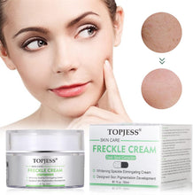 Carica l'immagine nel visualizzatore di Gallery, Crema Sbiancante, Sbiancante,Whitening Cream,Crema Macchie Macchie...