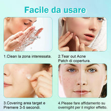 Carica l'immagine nel visualizzatore di Gallery, Patch Brufoli Pimple Patch Cerotti Viso Invisibili 264 pezzi