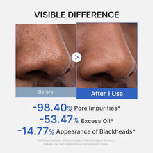 Carica l'immagine nel visualizzatore di Gallery, medicube Zero Pore Blackhead Mud Facial Mask