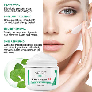 Cicatrici Crema, Scar cream Rimuovere Cicatrici Chirurgiche, Cicatrici Acne i Smagliature Veloce Efficace Su Cheloide, Ustione, Bruciatura