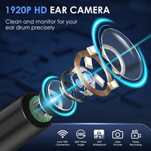 Carica l'immagine nel visualizzatore di Gallery, Xylla Otoscopio Pulizia Orecchie con Telecamera Ultra HD 1920P 3,5mm,Endoscopio Professionale WIFI Con 6 Luci LED,Pulizi