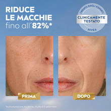 Carica l'immagine nel visualizzatore di Gallery, NIVEA Luminous630 Siero Viso Trattamento Avanzato Anti-Macchie, 30 ml