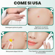 Carica l'immagine nel visualizzatore di Gallery, 397 Pezzi Cerotti Brufoli, Invisibile Naturale Hydrocolloid Patch 2 in 1 Giorno e Notte Che Invisibile Patch Brufoli Ass