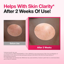 Carica l'immagine nel visualizzatore di Gallery, ANUA Siero al 10% di niacinamide + 4% di acido tranexamico, ceramide, acido ialuronico, vitamina B12, colore naturale, p