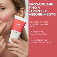 Carica l'immagine nel visualizzatore di Gallery, MOST - Crema 2s con Acido Salicilico e Zolfo, Crema Viso e Corpo Controlla Rossori e Prurito, Attenua Sfoghi da Stress, 