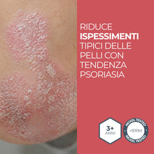 Carica l'immagine nel visualizzatore di Gallery, MOST - Crema 2s con Acido Salicilico e Zolfo, Crema Viso e Corpo Controlla Rossori e Prurito, Attenua Sfoghi da Stress, 