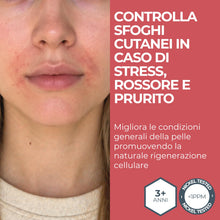 Carica l'immagine nel visualizzatore di Gallery, MOST - Crema 2s con Acido Salicilico e Zolfo, Crema Viso e Corpo Controlla Rossori e Prurito, Attenua Sfoghi da Stress, 