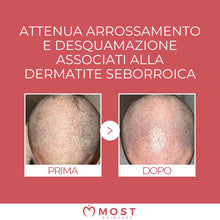 Carica l'immagine nel visualizzatore di Gallery, MOST - Crema 2s con Acido Salicilico e Zolfo, Crema Viso e Corpo Controlla Rossori e Prurito, Attenua Sfoghi da Stress, 