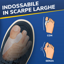 Carica l'immagine nel visualizzatore di Gallery, Alluce Valgo Correttore Tutore Alluce Valgo 6 Pezzi Silicone