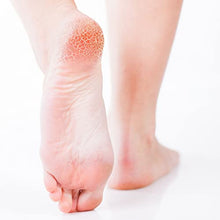 Carica l'immagine nel visualizzatore di Gallery, Altrapelle - Gel Multifunzionale Micosi Piede - 30 ml - Contrasta le Dermatofitosi dei Piedi - Senza Parabeni - Made in Italy