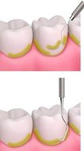 Carica l&#39;immagine nel visualizzatore di Gallery, Dentale Sbiancamento dei denti Tartaro e targa Rimozione Sonda a specchio Kit - Ilgrandebazar