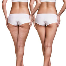 Carica l'immagine nel visualizzatore di Gallery, Tesmed Cell massaggiatore anticellulite