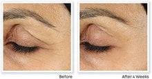 Carica l'immagine nel visualizzatore di Gallery, RoC - Retinol Correxion Levigatura delle Linee Crema Contorno Occhi - Riduce Visibilmente Gonfiori e Occhiaie - Antirughe e Antieta - 15 ml
