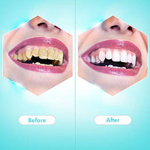 Carica l&#39;immagine nel visualizzatore di Gallery, pulizia denti, Dentale Tartaro Rimozione, Denti, rimuovere Placca A