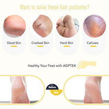 Carica l'immagine nel visualizzatore di Gallery, AGPTEK Kit Pedicure Professionale da 18 Pezzi Lime in Acciaio Inossidabile...