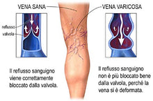 Carica l&#39;immagine nel visualizzatore di Gallery, CREMA CONTRO LE VENE VARICOSE PRIMO CLASSIFICATO 2019-2020 VARICASTAN...