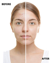 Carica l'immagine nel visualizzatore di Gallery, Hivexagon Kit Micro-ago Roll 4-in-1-3 Testine Separate con Numero 4 In 1 - Ilgrandebazar