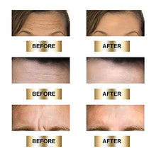 Carica l&#39;immagine nel visualizzatore di Gallery, Patch Antirughe,Cerotti Antirughe Fronte,Anti Wrinkle Patches,maschera... - Ilgrandebazar