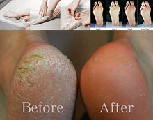 Carica l&#39;immagine nel visualizzatore di Gallery, Maschera per il piede Esfoliazione Pedicure | Per i piedi morbidi 1 Paio